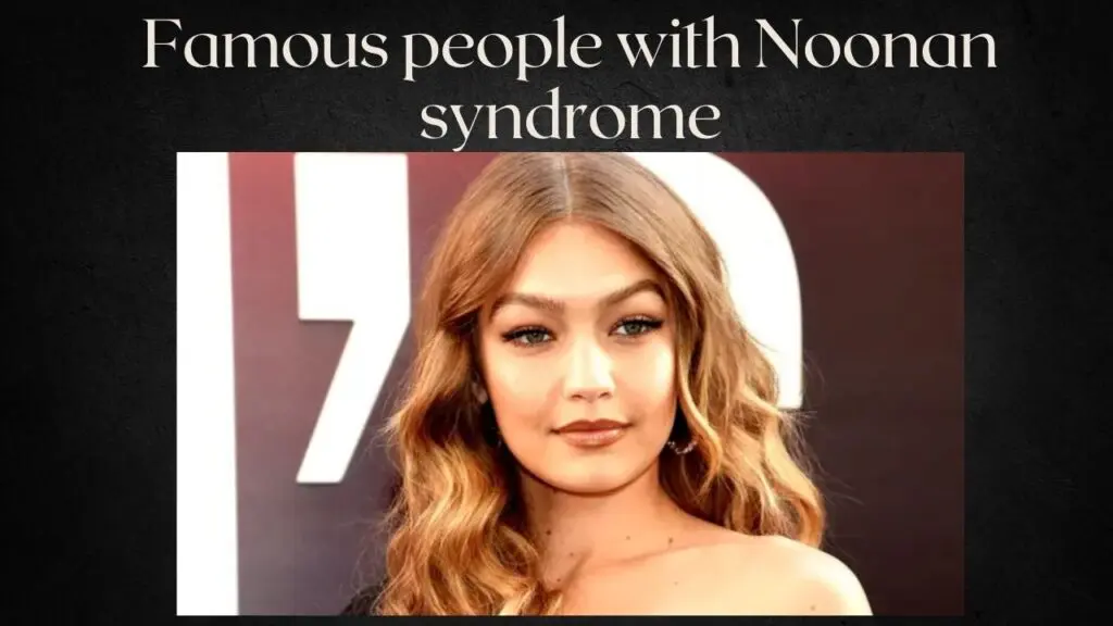 Famous-people-with-Noonan-syndrome